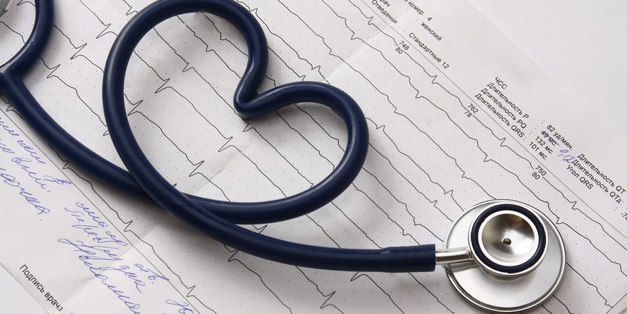 Stethoscope on an ECG printout