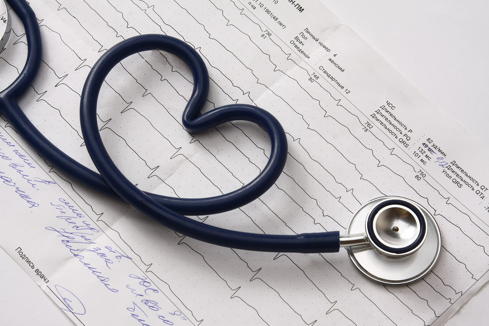 Stethoscope shaped like a heart on an ECG